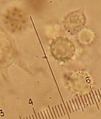 Laccaria ohiensis spores