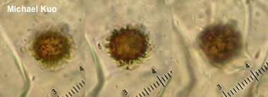 Scleroderma spores