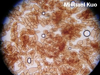 Cystoderma granulosum cuticular hyphae