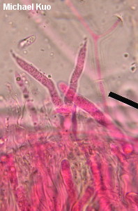Dacryopinax elegans