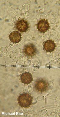 Scleroderma areolatum