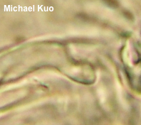 Scleroderma michiganense