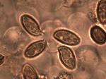 Boletellus chrysenteroides basidium with spores