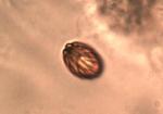 Boletellus chrysenteroides spore