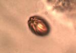 Boletellus chrysenteroides spore