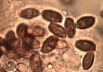 Boletellus chrysenteroides spores