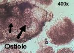 Trichoderma alutaceum ostiole