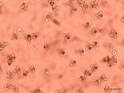 Tetrapyrgos nigripes spores
