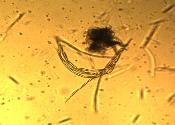 Tolypocladium longisegmentum ascus