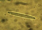 Tolypocladium longisegmentum part spore