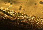 Tolypocladium longisegmentum epidermis