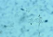 Tolypocladium ophioglossoides partspores