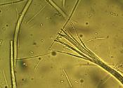 Tolypocladium ophioglossoides ascus