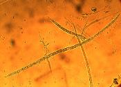 Tolypocladium ophioglossoides ascus