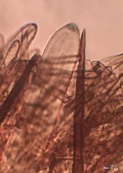 Trichoglossum hirsutum seta