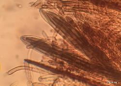 Trichoglossum hirsutum paraphyses