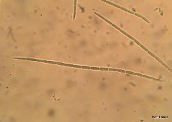 Trichoglossum hirsutum ascospores