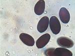 Coprinellus flocculosus spores