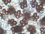 Coprinopsis variegata basidia with spores