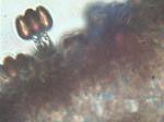 Coprinopsis variegata basidium with spores
