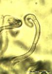 Geoglossum difforme paraphyses