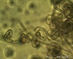 Geoglossum difforme paraphyses