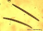 Geoglossum difforme spores