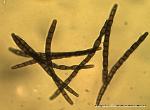 Geoglossum difforme spores