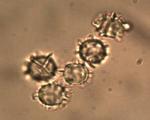 Lactarius lignyotus spores