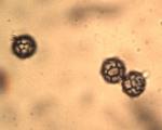 Lactarius volemus var. flavus spores