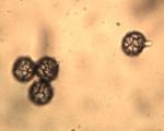 Lactarius volemus var. flavus spores
