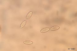 Peziza phyllogena ascospores
