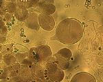 pileipellis cells of pluteus romellii 